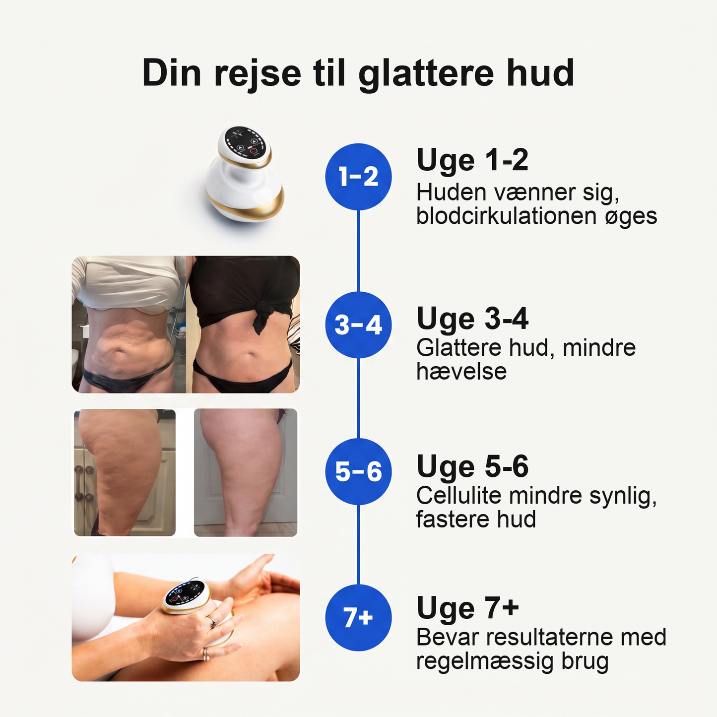 Zvarelo — Celluliteapparatet der giver glattere og fastere hud uden klinikbesøg