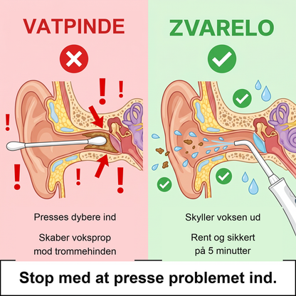 Zvarelo — Ørerenseren der fjerner voksproppen hjemme på 3 minutter uden vatpinde eller klinikbesøg